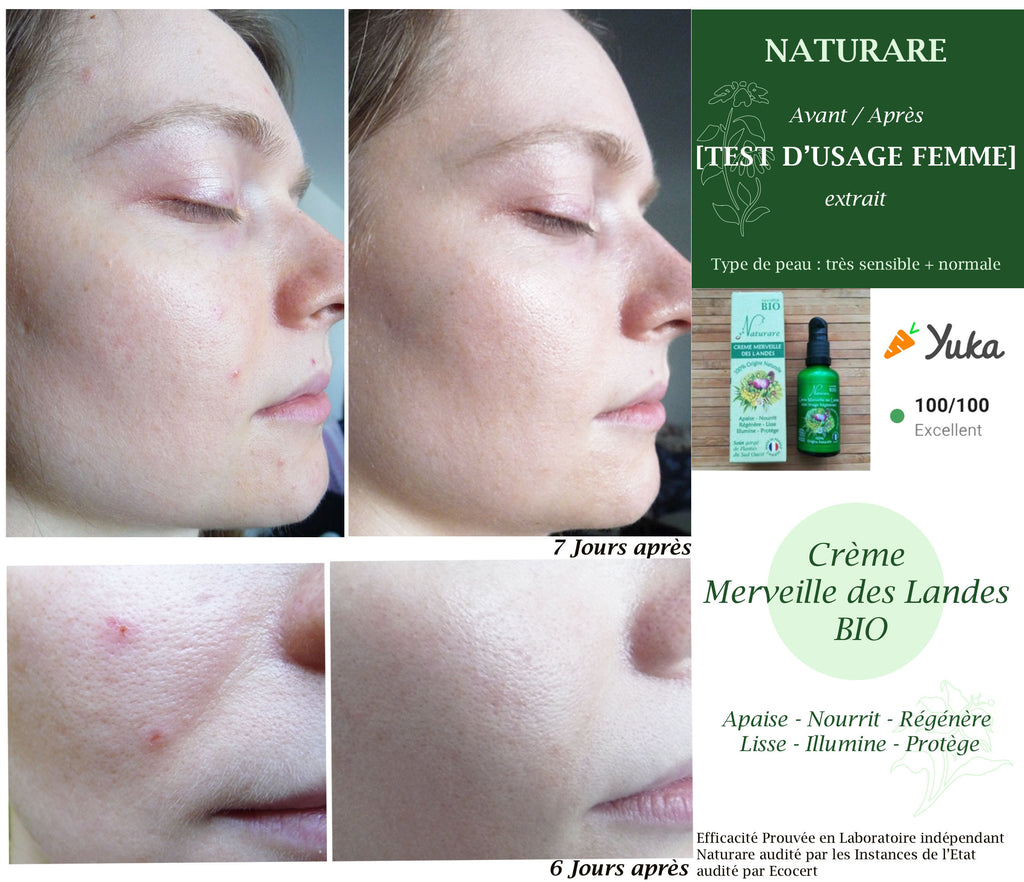 PRO - MERVEILLE DES LANDES ORGANIC - Sensitive Skin Care Complete Regeneration