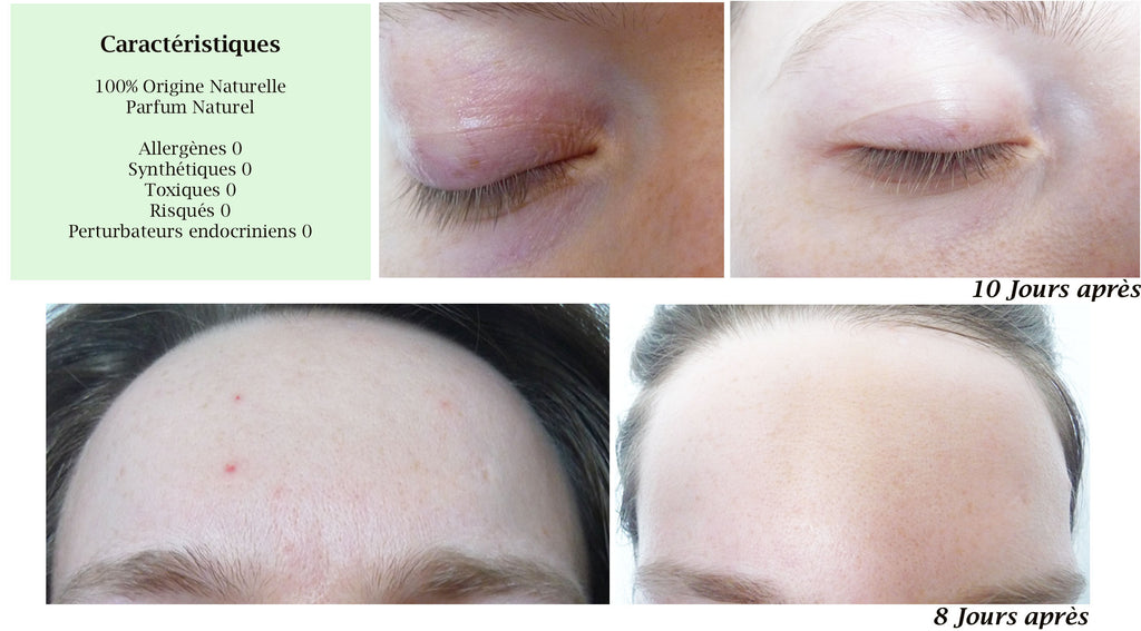 PRO - MERVEILLE DES LANDES ORGANIC - Sensitive Skin Care Complete Regeneration